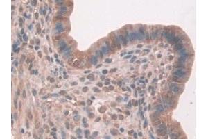 Immunohistochemistry (IHC) image for anti-Fibroblast Activation Protein, alpha (FAP) (AA 542-761) antibody (ABIN7434938)