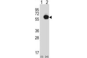 Western Blotting (WB) image for anti-Ran GTPase Activating Protein 1 (RANGAP1) antibody (ABIN2997532) (RANGAP1 antibody)