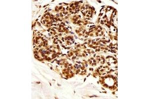 Immunohistochemical staining of paraffin-embedded human breast section reacted with PIN1 monoclonal antibody  at 1:25 dilution. (PIN1 antibody)