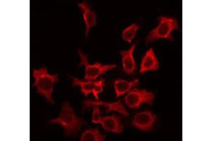 ABIN6266625 staining HepG2 by IF/ICC. (KCNC2 antibody  (C-Term))