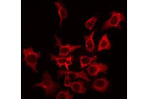 ABIN6266625 staining HepG2 by IF/ICC. (KCNC2 antibody  (C-Term))