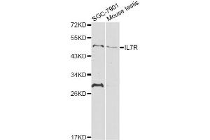 Western blot analysis of extracts of various cell lines, using IL7R antibody. (IL7R antibody)