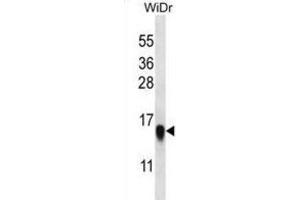 Western Blotting (WB) image for anti-Ribosomal Protein L35 (RPL35) antibody (ABIN2997048)