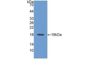 Detection of Recombinant CD99, Rat using Polyclonal Antibody to Cluster Of Differentiation 99 (CD99) (CD99 antibody  (AA 26-160))