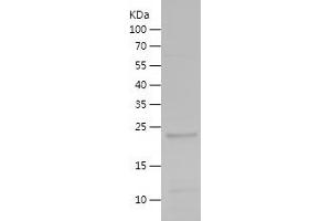 NOS2 Protein (AA 19-221) (His tag)