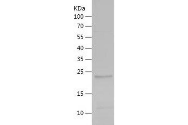 NOS2 Protein (AA 19-221) (His tag)