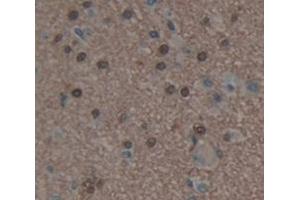 IHC-P analysis of Human Tissue, with DAB staining. (HDAC9 antibody  (AA 23-343))