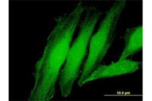 Immunofluorescence of purified MaxPab antibody to EXOSC1 on HeLa cell. (EXOSC1 antibody  (AA 1-195))