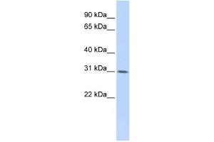WDR33 antibody used at 1 ug/ml to detect target protein.