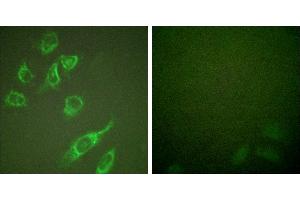 PMA + -Immunofluorescence analysis of HeLa cells, treated with PMA (125ng/ml, 30mins), using 14-3-3 ζ (phospho-Ser58) antibody. (14-3-3 zeta antibody  (pSer58))