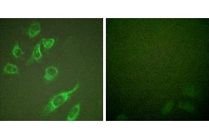 PMA + -Immunofluorescence analysis of HeLa cells, treated with PMA (125ng/ml, 30mins), using 14-3-3 ζ (phospho-Ser58) antibody.