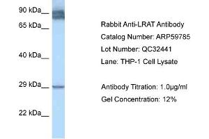 Western Blotting (WB) image for anti-Lecithin Retinol Acyltransferase (Phosphatidylcholine--Retinol O-Acyltransferase) (LRAT) (N-Term) antibody (ABIN2788210) (LRAT antibody  (N-Term))