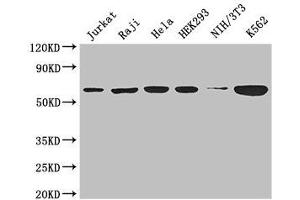 Western Blot Positive WB detected in: Jurkat whole cell lysate, Raji whole cell lysate, Hela whole cell lysate, HEK293 whole cell lysate, NIH/3T3 whole cell lysate, K562 whole cell lysate All lanes: CCT8 antibody at 3 μg/mL Secondary Goat polyclonal to rabbit IgG at 1/50000 dilution Predicted band size: 60, 58, 52 kDa Observed band size: 60 kDa (CCT8 antibody  (AA 224-491))