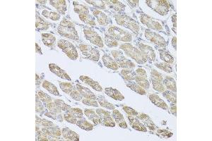 Immunohistochemistry of paraffin-embedded mouse stomach using MSMB antibody at dilution of 1:100 (x40 lens). (MSMB antibody)