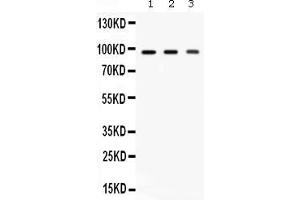 Western blot analysis of Ago2/eIF2C2 expression in rat brain extract ( Lane 1), mouse brain extract ( Lane 2) and HELA whole cell lysates ( Lane 3). (AGO2 antibody  (N-Term))