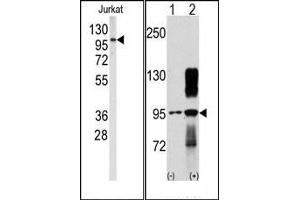 Image no. 1 for anti-Discoidin Domain Receptor tyrosine Kinase 2 (DDR2) antibody (ABIN359957) (DDR2 antibody)