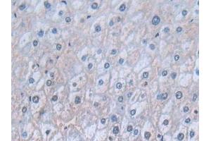 Detection of CD74 in Human Liver Tissue using Polyclonal Antibody to Cluster Of Differentiation 74 (CD74) (CD74 antibody  (AA 78-222))