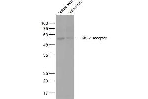 Lane 1: Mouse Spinal cord lysates Lane 2: Rat Spinal cord lysates probed with KiSS1 receptor Polyclonal Antibody, Unconjugated  at 1:2000 dilution and 4˚C overnight incubation. (KISS1R antibody  (AA 121-200))