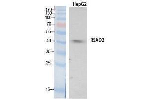Western Blotting (WB) image for anti-Radical S-Adenosyl Methionine Domain Containing 2 (RSAD2) (Internal Region) antibody (ABIN3178550) (RSAD2 antibody  (Internal Region))