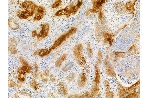 anti-Actinin, alpha 1/2/3/4 (ACTN1/ACTN2/ACTN3/ACTN4) (Internal Region) antibody