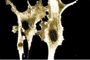 Immunofluorescence staining of human fibroblasts. (Annexin A2 antibody  (AA 123-328))