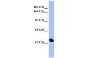 Image no. 1 for anti-Ras Protein-Specific Guanine Nucleotide-Releasing Factor 1 (RASGRF1) (AA 107-156) antibody (ABIN6744091) (RASGRF1 antibody  (AA 107-156))
