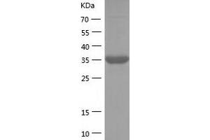Western Blotting (WB) image for Fission 1 (FIS1) (AA 1-122) protein (His-IF2DI Tag) (ABIN7122969) (Fission 1 Protein (FIS1) (AA 1-122) (His-IF2DI Tag))