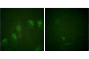 Immunofluorescence analysis of HeLa cells treated with Forskolin 40nM 30', using Myc (Phospho-Ser62) Antibody.