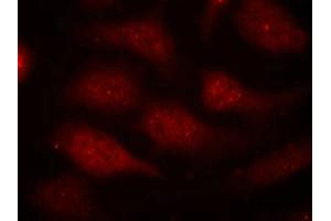 Immunofluorescence staining of methanol-fixed Hela cells using CDK6(phospho-Tyr24) Antibody. (CDK6 antibody  (pTyr24))