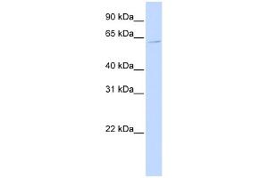 WB Suggested Anti-ZNF579 Antibody Titration:  0. (ZNF579 antibody  (Middle Region))