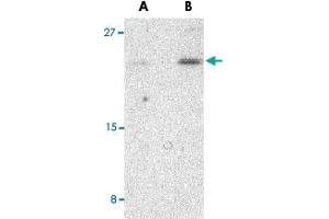 Western blot analysis of BIK in Jurkat cell lysate with BIK polyclonal antibody  at (A) 1 and (B) 2 ug/mL . (BIK antibody  (N-Term))