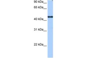 Western Blotting (WB) image for anti-RNA Binding Motif Protein 42 (RBM42) antibody (ABIN2462301)