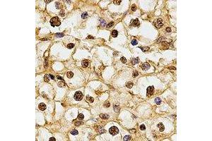 Immunohistochemistry (IHC) image for anti-Ribosomal Protein S5 (RPS5) antibody (ABIN7308294) (RPS5 antibody)