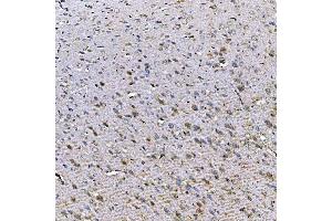 IHC analysis of TOM1L1 using anti-TOM1L1 antibody (ABIN7602631).