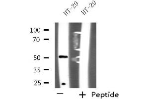 Western blot analysis of extracts from HT-29 cells, using NUSAP1 antibody. (NUSAP1 antibody  (C-Term))