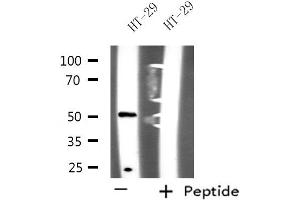 Western blot analysis of extracts from HT-29 cells, using NUSAP1 antibody.