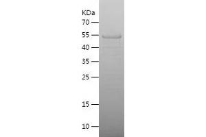 Western Blotting (WB) image for WW Domain Containing E3 Ubiquitin Protein Ligase 1 (WWP1) (AA 1-233) protein (His-IF2DI Tag) (ABIN7125747) (WWP1 Protein (AA 1-233) (His-IF2DI Tag))