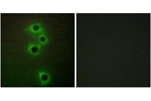 Immunofluorescence analysis of A549 cells, using MARK4 Antibody.