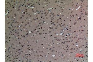 Immunohistochemistry (IHC) analysis of paraffin-embedded Rat Brain, antibody was diluted at 1:100. (SV2C antibody  (Internal Region))