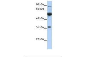 Image no. 1 for anti-Eukaryotic Translation Initiation Factor 2B, Subunit 1 Alpha, 26kDa (EIF2B1) (C-Term) antibody (ABIN6738798) (EIF2B1 antibody  (C-Term))