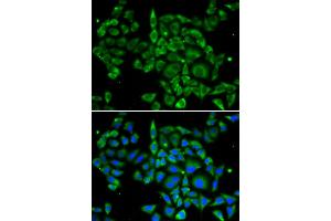 Immunofluorescence analysis of U2OS cells using PRKCA antibody. (PKC alpha antibody)