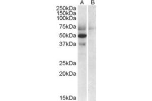 Western Blotting (WB) image for anti-Apolipoprotein L, 4 (APOL4) (C-Term) antibody (ABIN2466654)