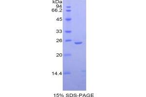 SDS-PAGE analysis of IL27 Protein. (IL-27 Protein)