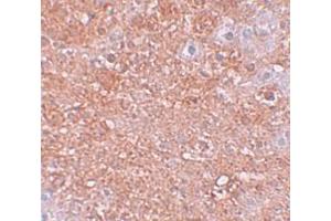 Immunohistochemistry (IHC) image for anti-Solute Carrier Family 39 (Zinc Transporter), Member 12 (SLC39A12) (N-Term) antibody (ABIN1031680) (SLC39A12 antibody  (N-Term))