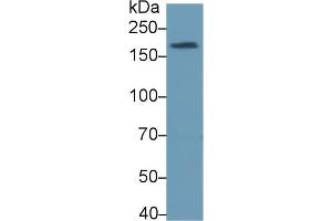 Detection of TOPBP1 in Human Serum using Polyclonal Antibody to Topoisomerase II Binding Protein 1 (TOPBP1) (TOPBP1 antibody  (AA 1-250))