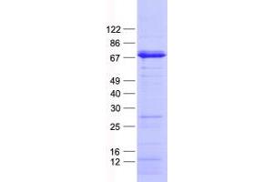 Validation with Western Blot (ETV4 Protein (His tag))