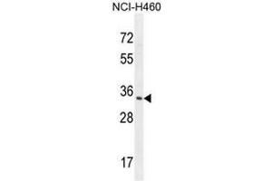 RNT2 Antibody (N-term) western blot analysis in NCI-H460 cell line lysates (35µg/lane). (RNASET2 antibody  (N-Term))