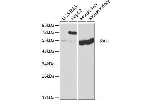 Western blot analysis of extracts of various cell lines using PAH Polyclonal Antibody at dilution of 1:1000. (Phenylalanine Hydroxylase antibody)