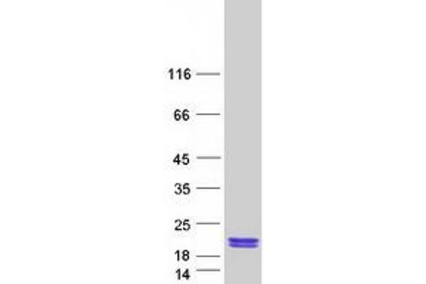PTRHD1 Protein (Myc-DYKDDDDK Tag)