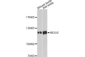 Western blot analysis of extracts of various cell lines, using MEIOC antibody. (Gm1564 antibody)